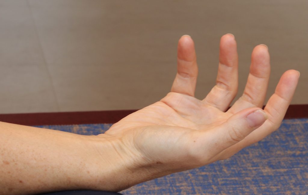 Private Physiotherapy for Hands and Upper Limb problems